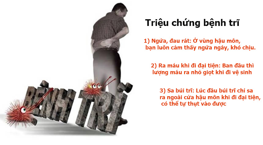 Chữa bệnh trĩ nhà thuốc ông Lang Hoán